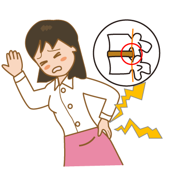 椎間板ヘルニアとは